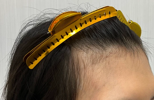 施術前の症例画像