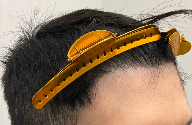 施術後の症例画像