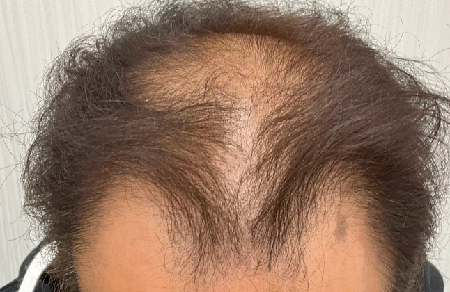 施術前の症例画像