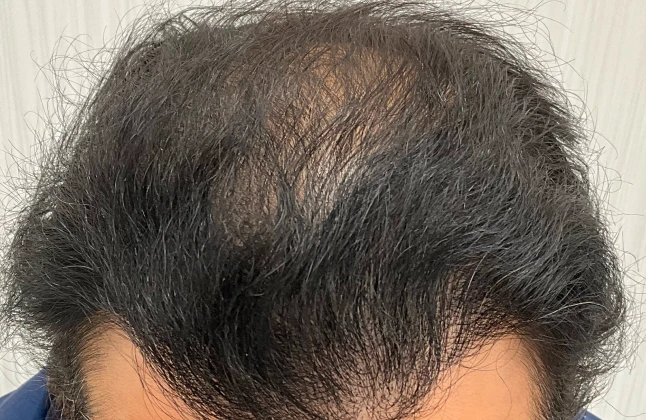 施術後の症例画像