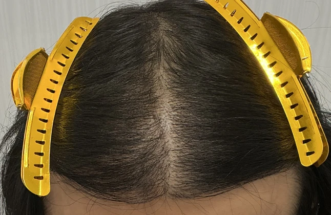 施術後の症例画像