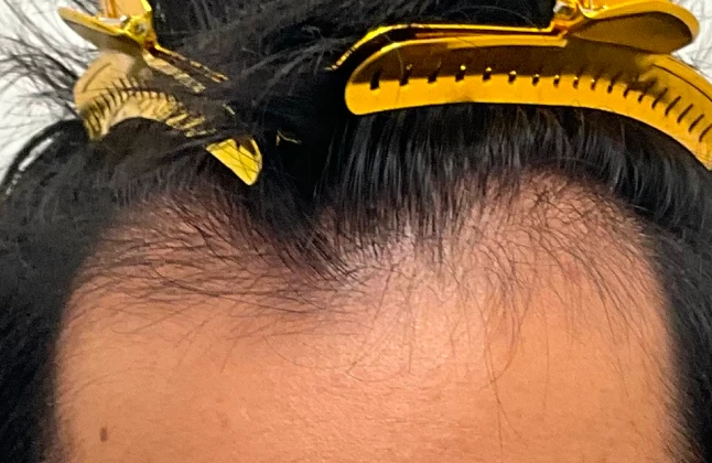 施術前の症例画像