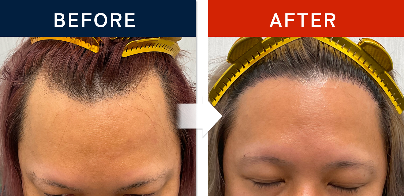 施術前後の症例画像