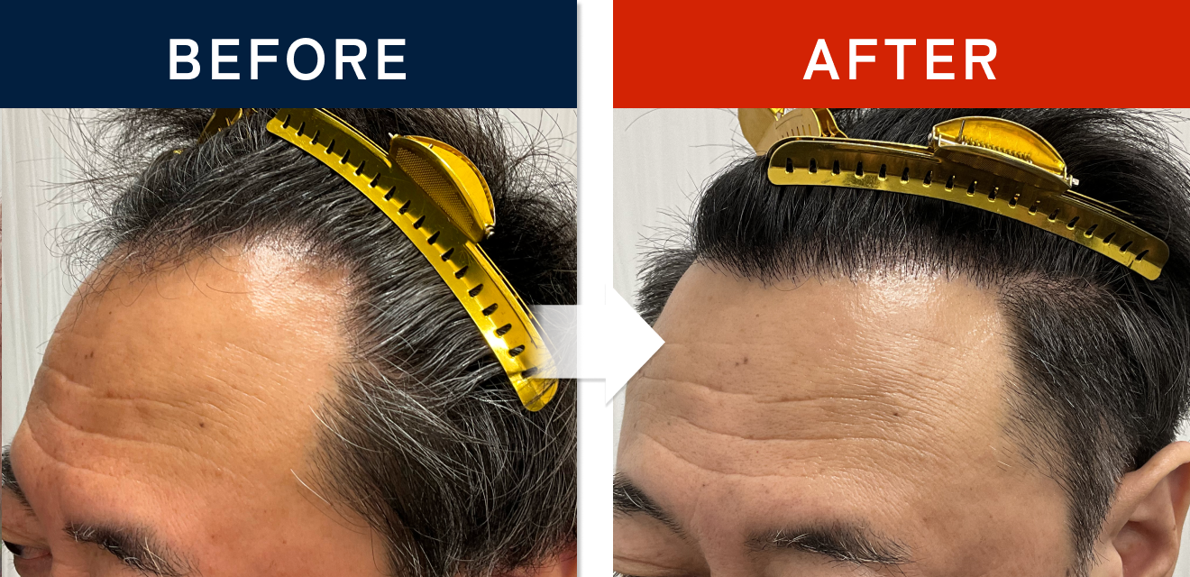 施術前後の症例画像