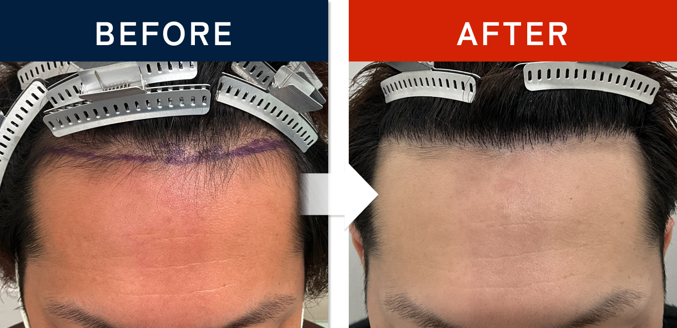 施術前後の症例画像