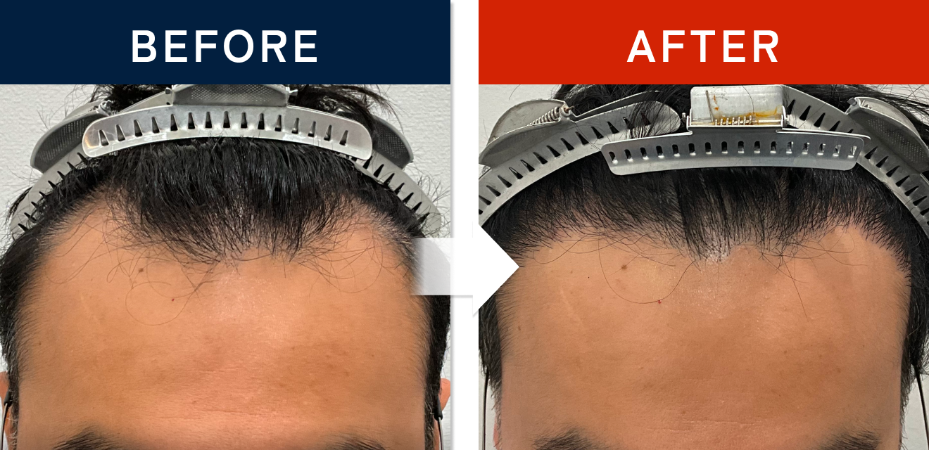 施術前後の症例画像