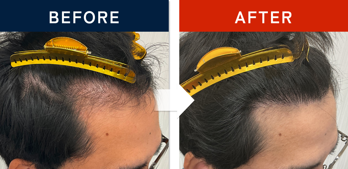 施術前後の症例画像