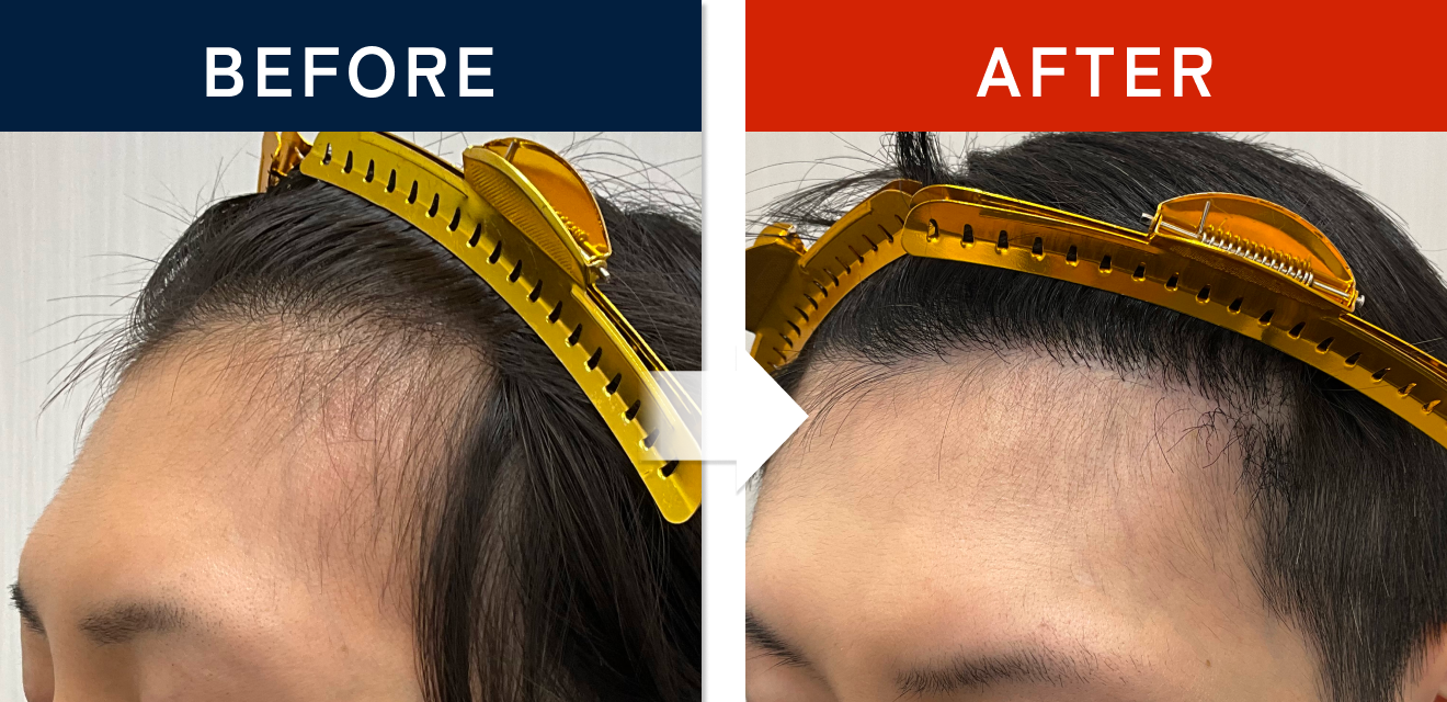 施術前後の症例画像