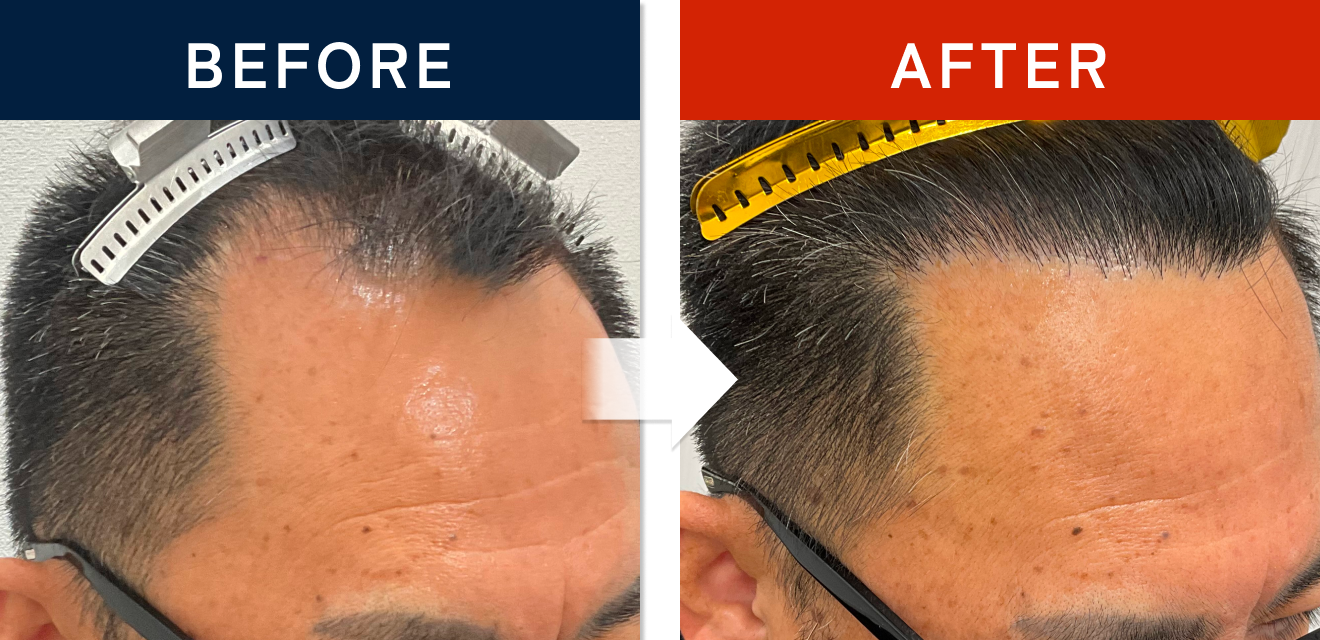 施術前後の症例画像