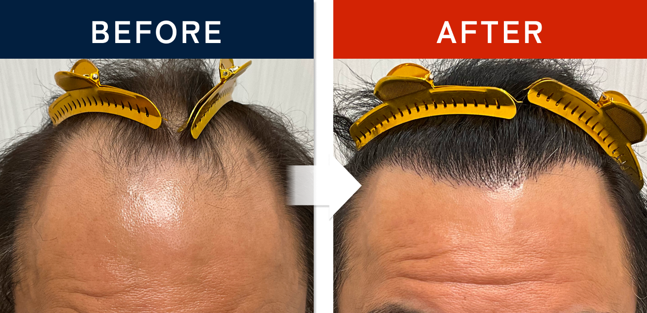 施術前後の症例画像