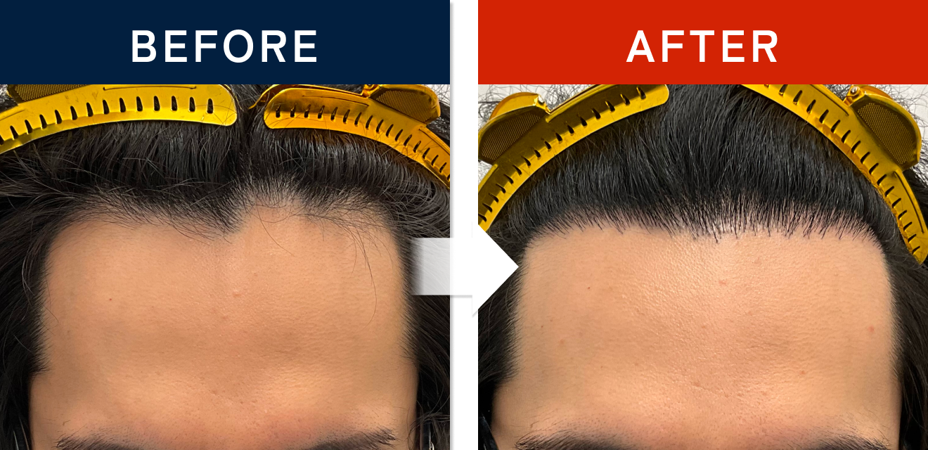 施術前後の症例画像