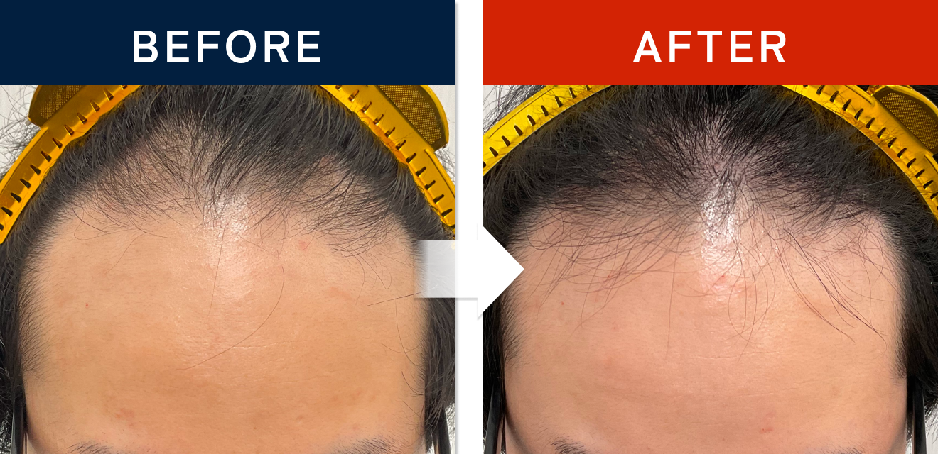 施術前後の症例画像