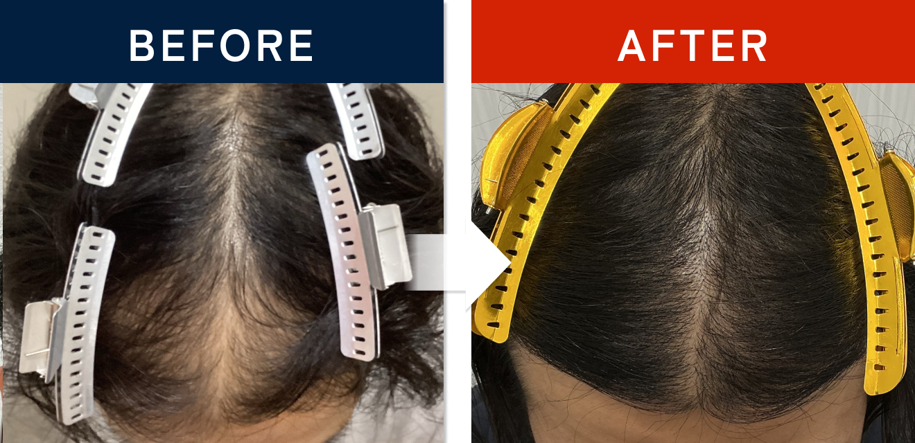 施術前後の症例画像