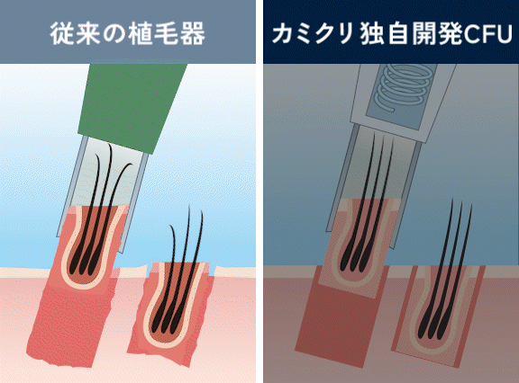 イラスト画像