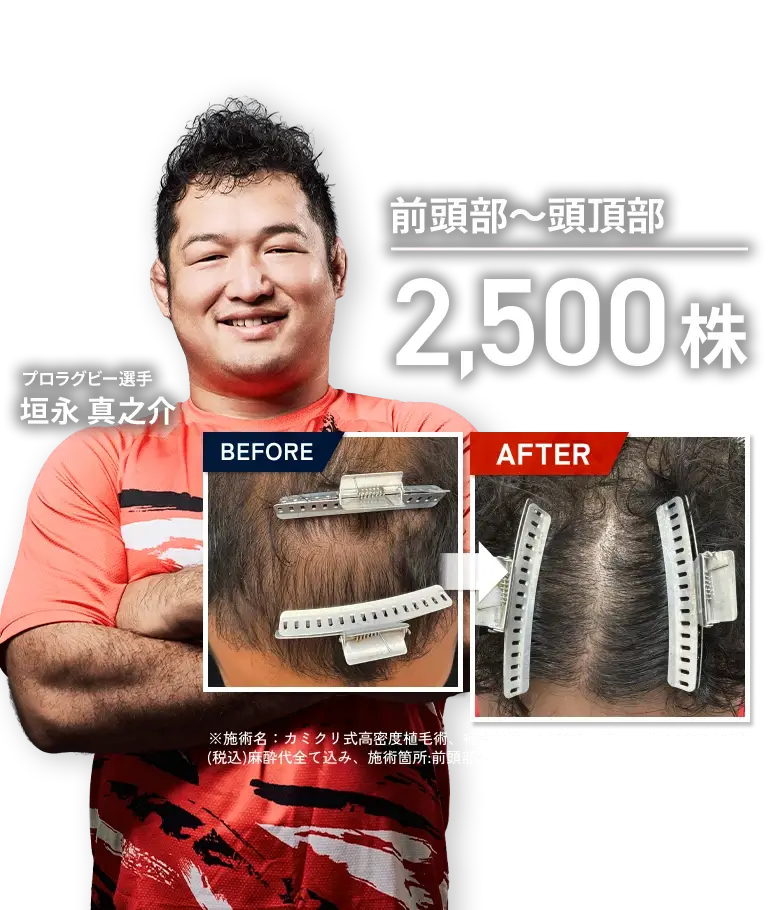 スライド画像