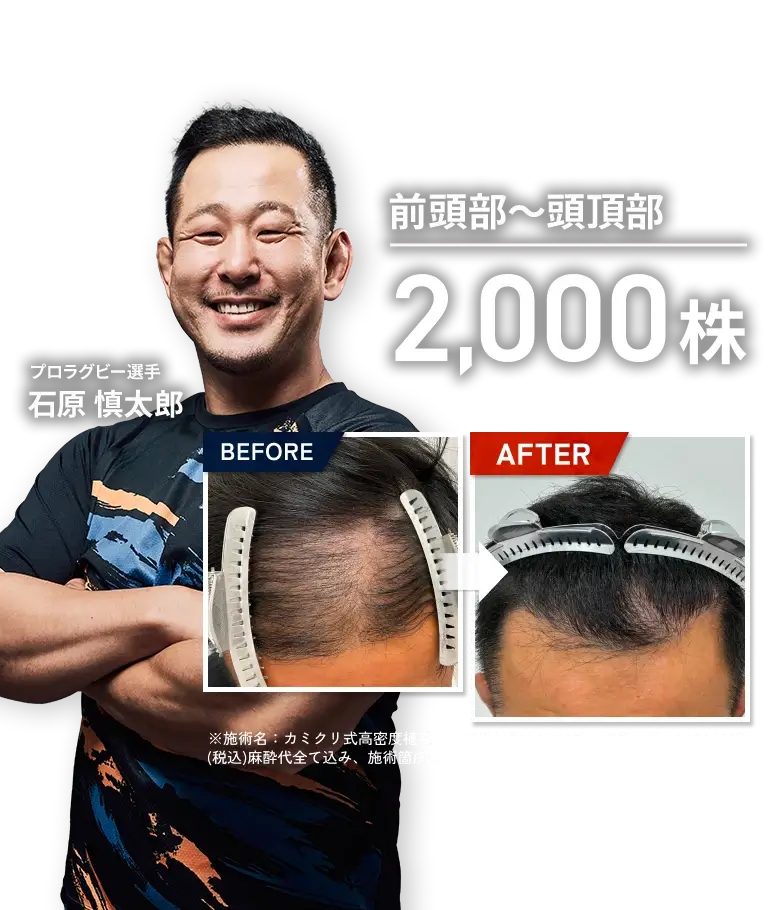 スライド画像