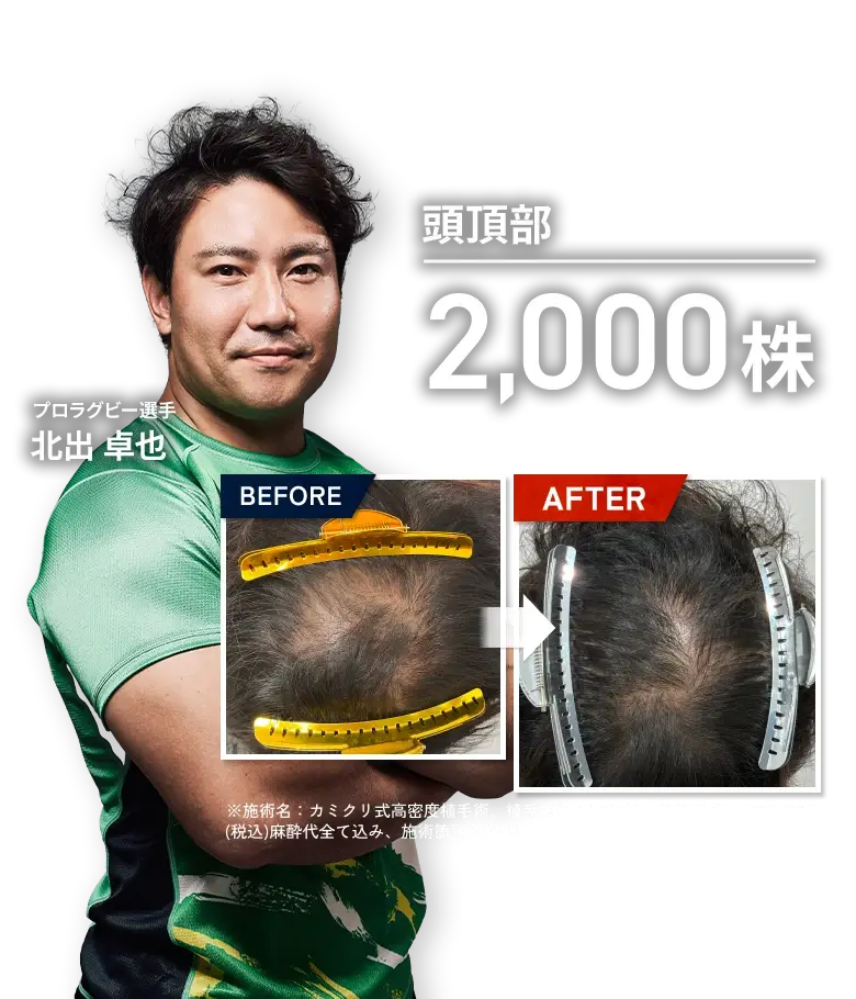 スライド画像
