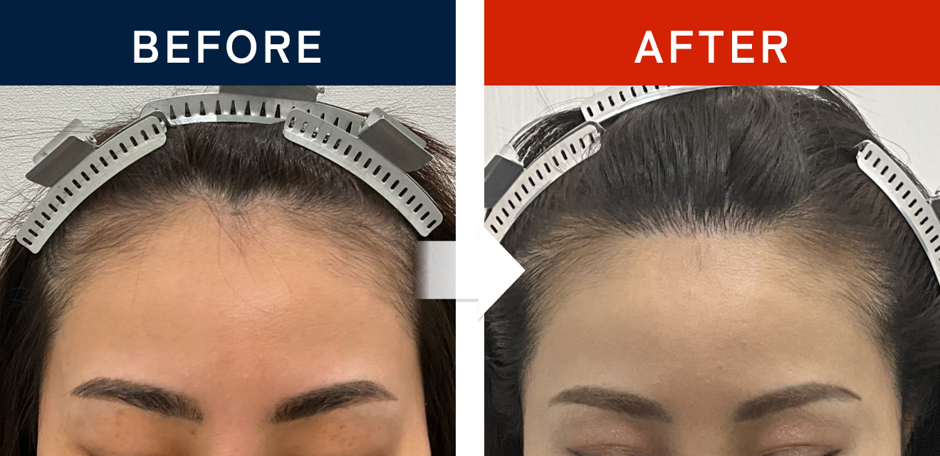 施術前後の症例画像