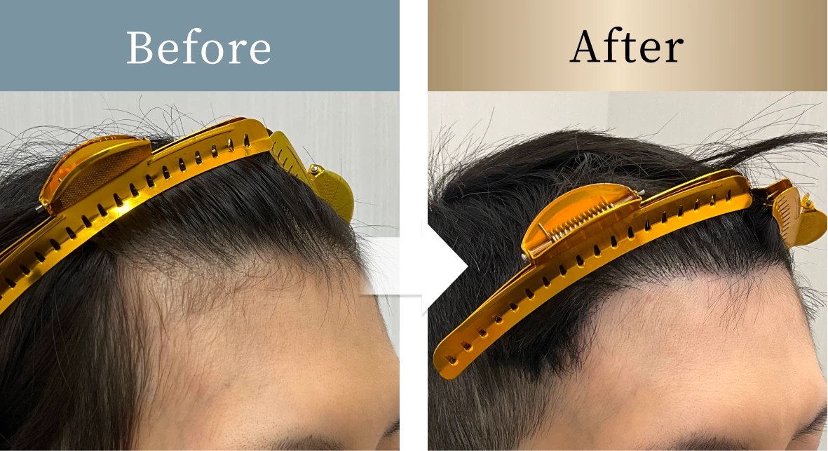 beforeとafterの画像