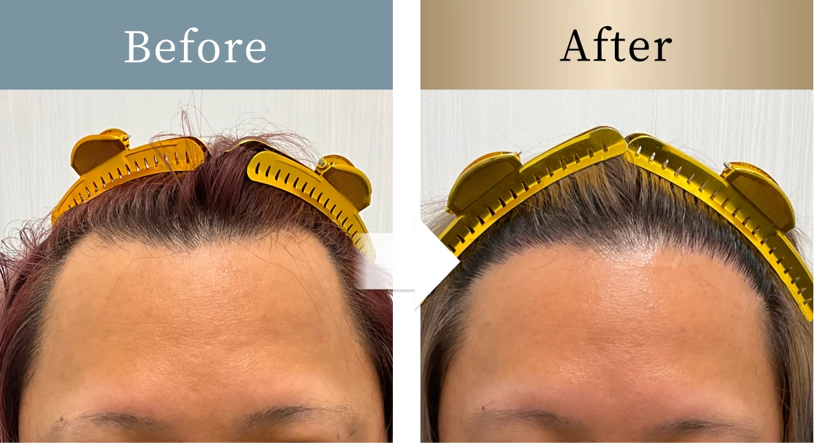 beforeとafterの画像