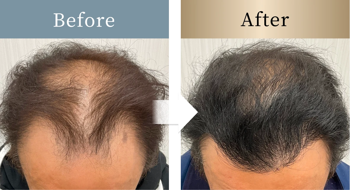 beforeとafterの画像