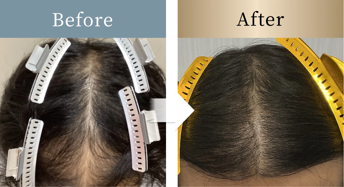 beforeとafterの画像